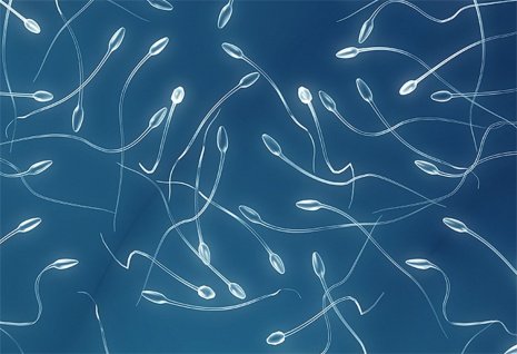 Виды патоспермии: астенозооспермия, азооспермия, олигозооспермия и другие