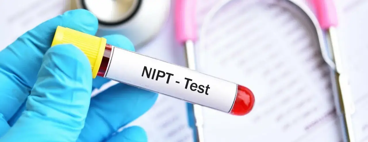 Коронарография